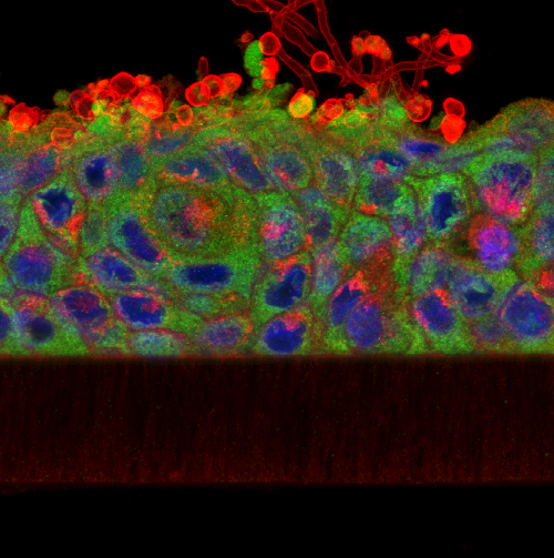 Image showing yeast cells colonising a tissue-engineered oral epithelium