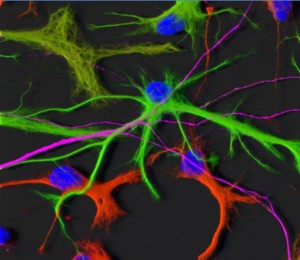 Fluorescence image of neurons showing four distinct coloured stains