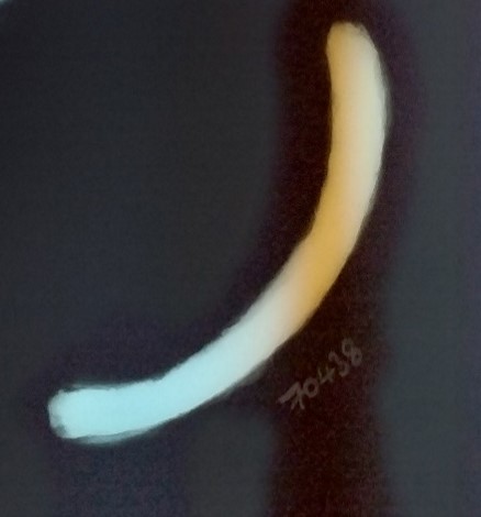 Photograph of an X-ray of a curved bar seen along one edge.