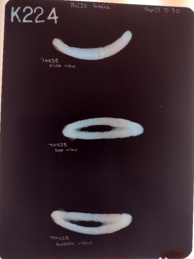 A photograph of X rays of the curved iron bar find number 70438 taken of its side, from a top view and from the bottom, revealed its loop shape.