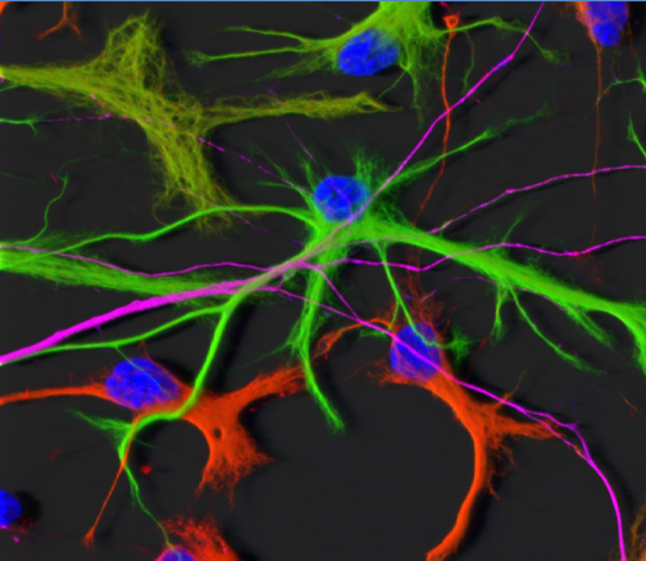 Optimising brain cell imaging: Gray matters