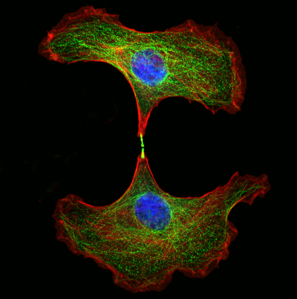 two endothelial cells showing a region of binding between them