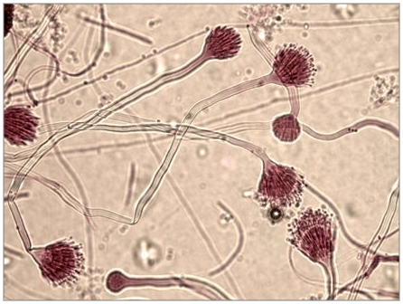 Image of Aspergillus terreus, a fungus.