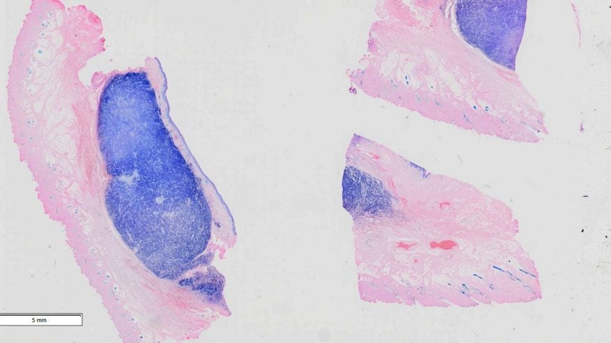 Mast-cell-tumour-giemsa-stain