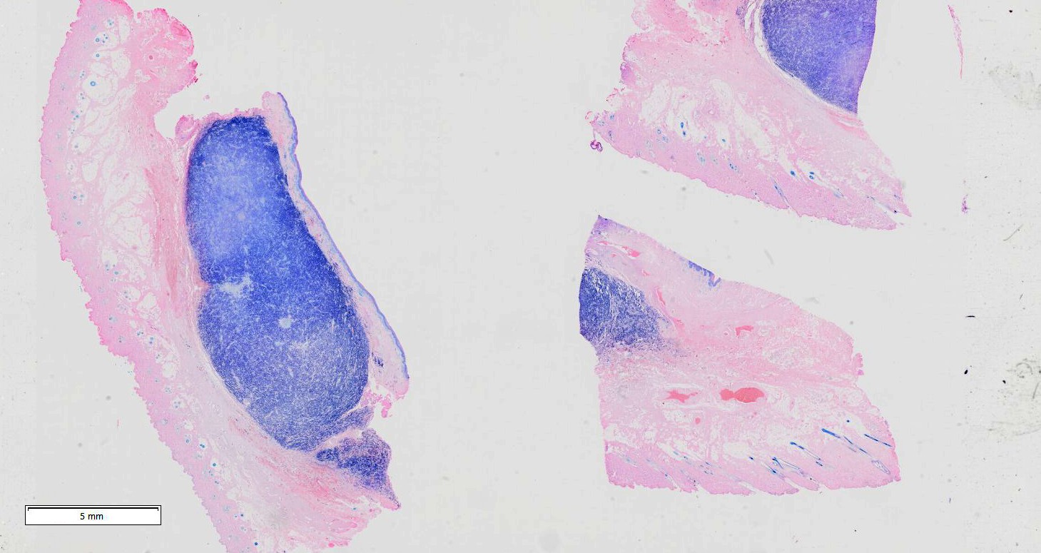 A picture of a slide section of a mast tumour cell