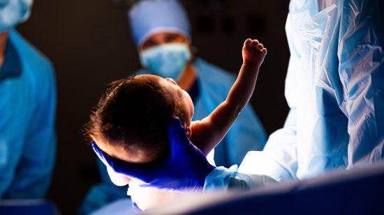 Y tu ôl i’r datblygiad arloesol: pam mae angen ystyried trawsblaniadau’r groth yn fyd-eang