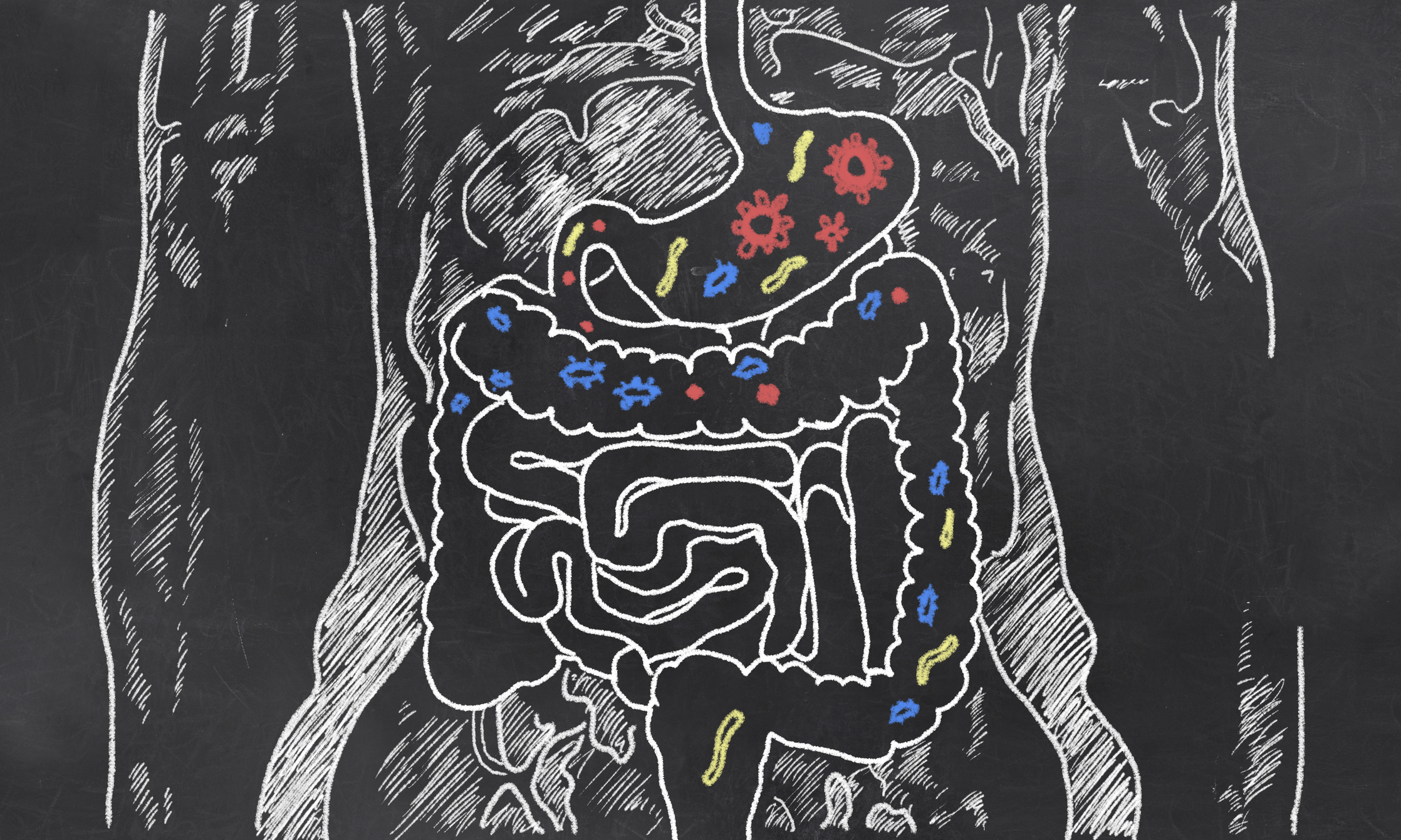 Does Parkinson’s disease start in the stomach?
