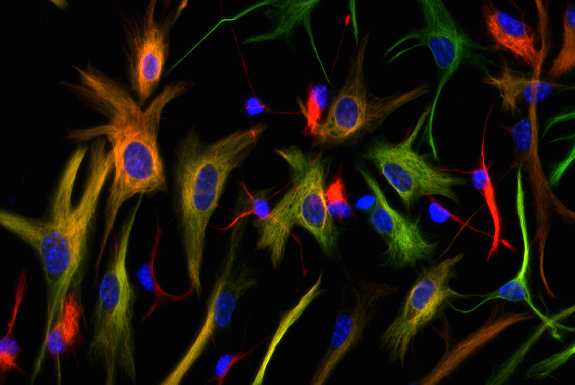 The immune system and the brain: complement or casualty?